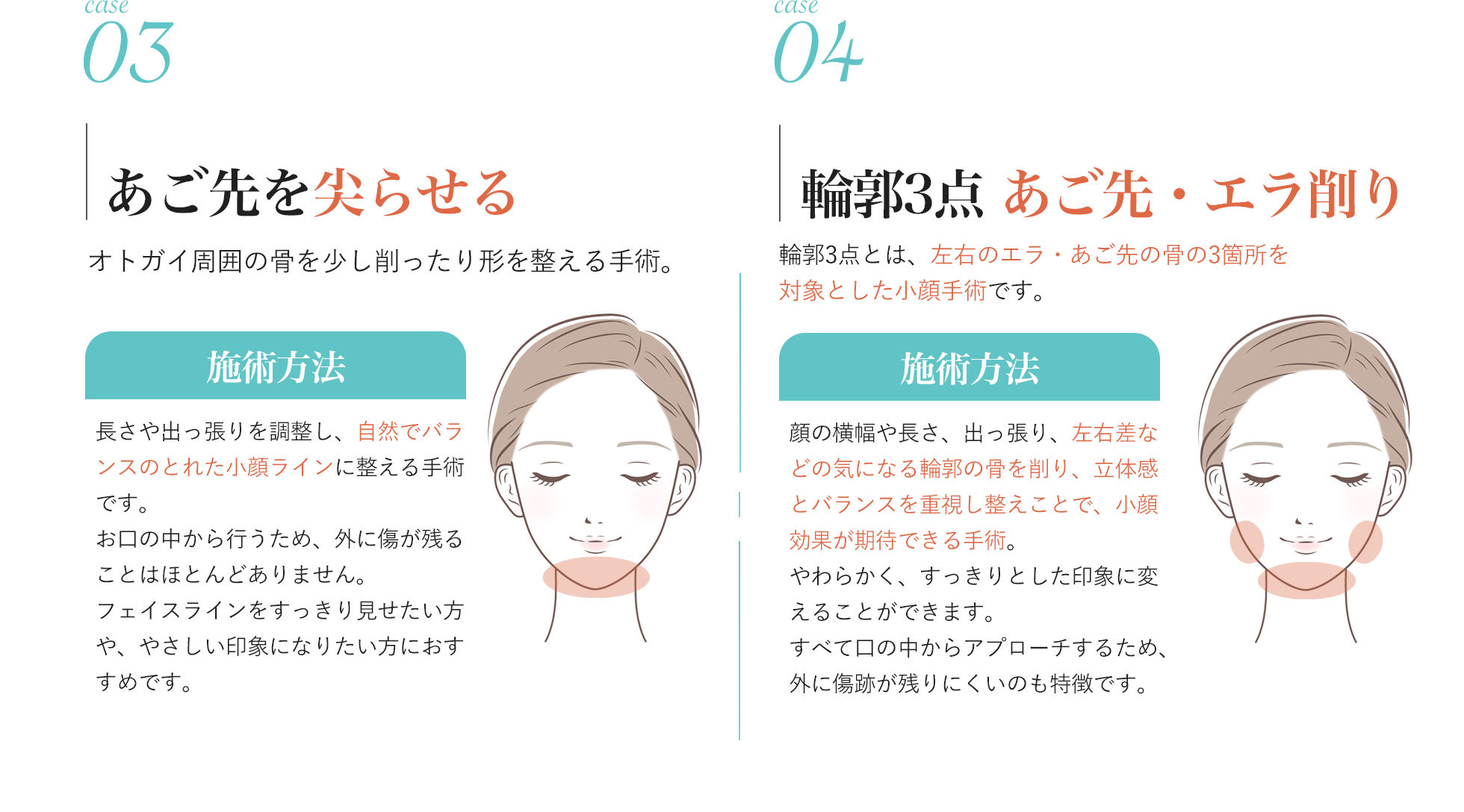 あご先・エラ削り・輪郭3点