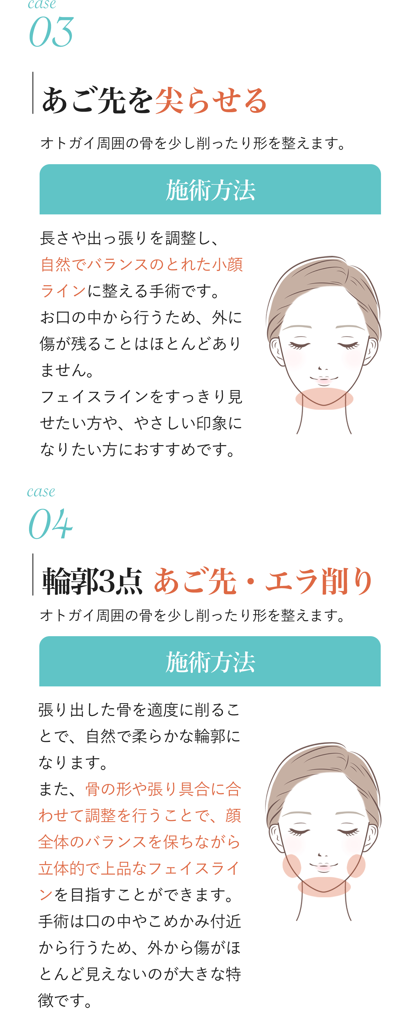 あご先・エラ削り・輪郭3点