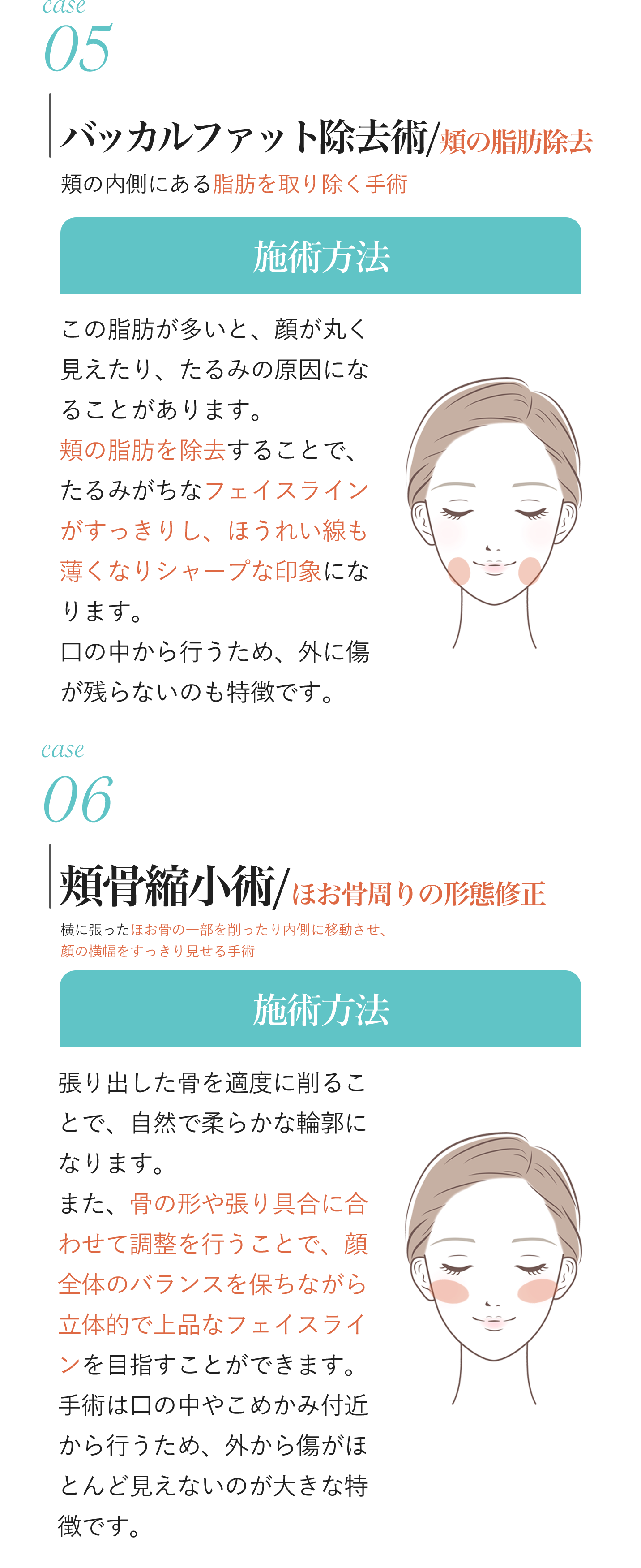 バッカルファット・頬骨縮小術